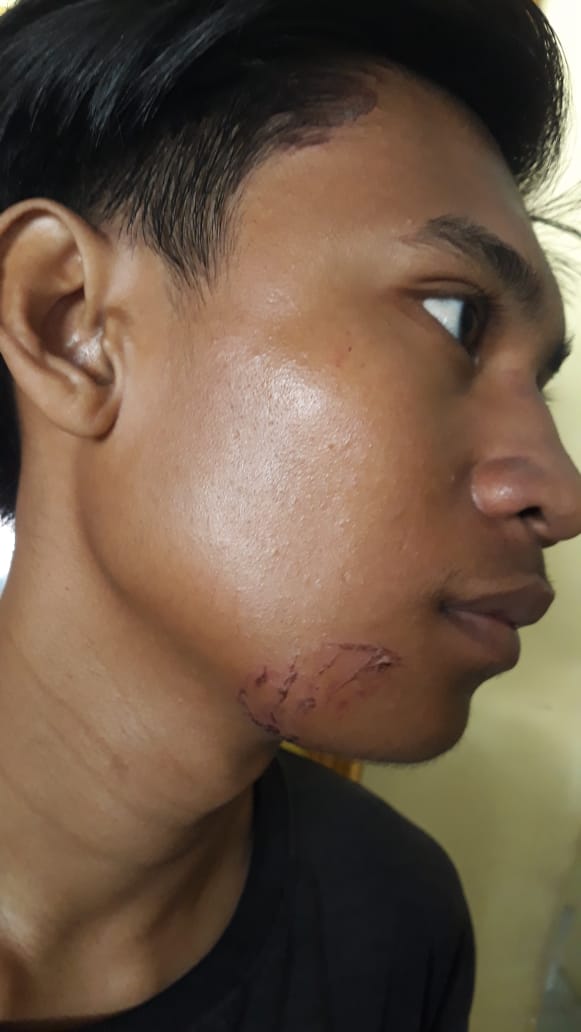 Penganiayaan Berdarah Pemuda Totopo Dikeroyok Beberapa Preman Di Simpang Tiga Alfamart